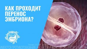 КАК ПРОХОДИТ ПЕРЕНОС ЭМБРИОНА? #беременность #репродукция  #переносэмбриона #эко