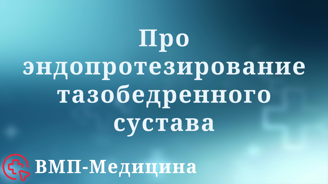 Эндопротезирование тазобедренного сустава | ВМП-Медицина