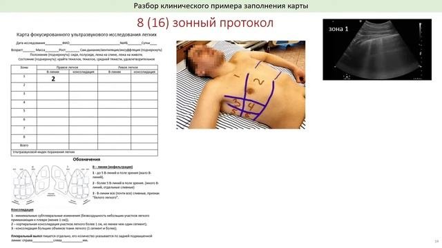 Методика фокусированного ультразвукового осмотра легких