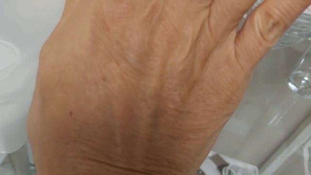 АирисКом студенты учатся: мезотерапия для лифтинга кожи рук. смотреть онлайн