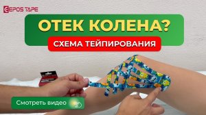 Отеки колленного сустава. Тейпирование колена. Тейпы от отеков.