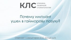 Почему имплант ушел в гайморову пазуху? Отвечает главный врач КЛС Белый Д.В.