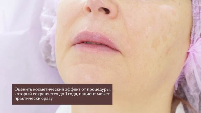 Ботулинотерапия, Контурная пластика губ,Коррекция углов челюсти, формы подбородка,носогубных складо смотреть онлайн