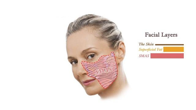 Facelift Anatomy | How Face Lifts work | Aesthetic Minutes #Facelift #Anatomy
