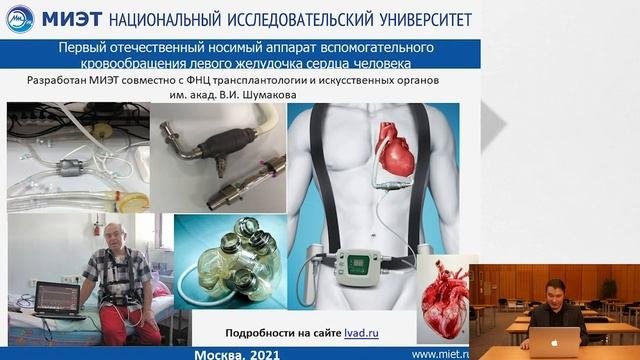 Как искусственные органы регулируют процессы в организме