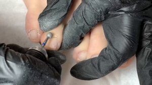 ПЕДИКЮР. Вросший ноготь. Педикюр сама себе