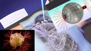 Лечение магнитами рецепты 38 46 Магнитотерапия будущего,