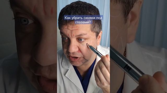 Как быстро избавиться от синяков под глазами?