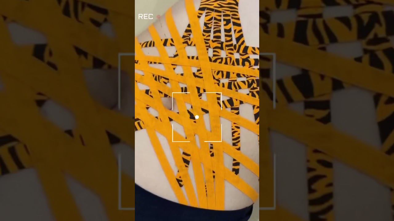 Тейпирование живота  #тейп #тейпирование #тейпированиеживота #тейпы