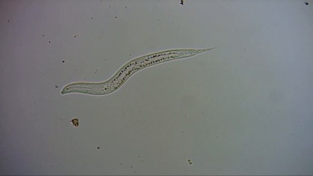 Цветочная вода под микроскопом part 1 смотреть онлайн