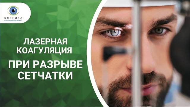 Лазерная коагуляция при разрыве сетчатки - суть процедуры