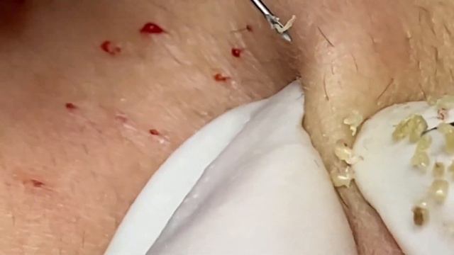 Enjoy Your Day With Hien Nguyen Spa # 1616 смотреть онлайн