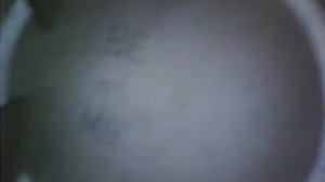 Хундай Солярис, проверка поршней эндоскопом.