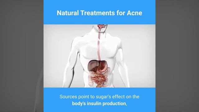 Do you have acne? this is the effective way to get rid of it.  Natural Treatments for ACNE