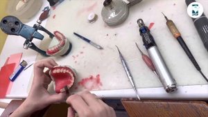 Процесс изготовления акриловых протезов.
