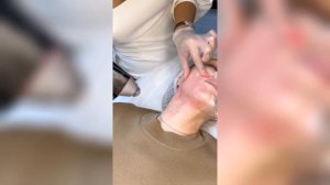 Микроигольчатый рф-лифтинг для расслабления платизмы