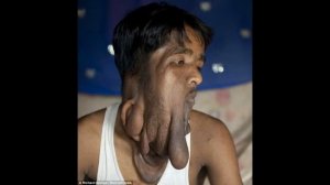 Необычные болезни меняющие людей до неузнаваемости