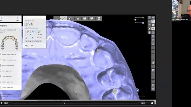 [Webinar] Occlusal Excellence in a Digital World with Dr. John Cranham