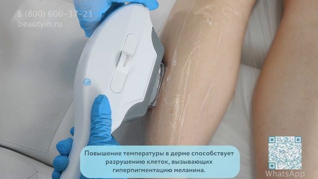ELOS prof - 1 000 000 вспышек удаление волос и омоложение ЭЛОС смотреть онлайн
