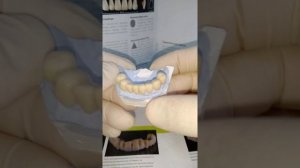 несъемный зубной протез