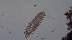 Питание инфузории / Paramecium feeding