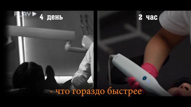 Зубы за один день. Новые зубы за 1 день. Зубные коронки за 1 посещение стоматологии.