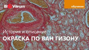 Окраска по Ван Гизону