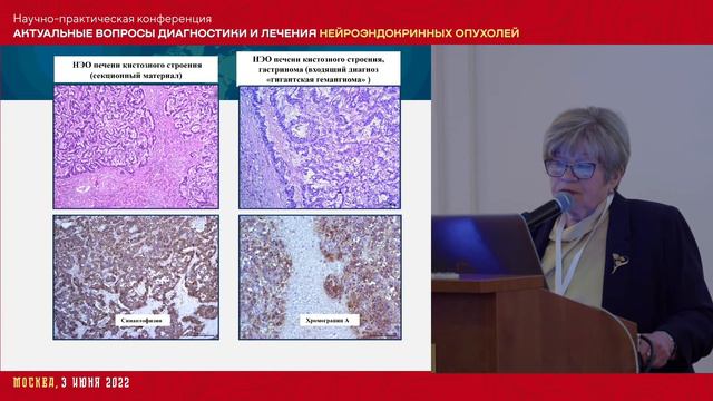 Современные подходы к морфологическому исследованию НЭН различной локализации // Гуревич Л.Е.