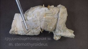 полость гортани, мышцы гортани, строение гортани (оболочки)