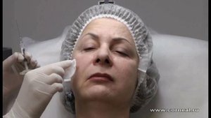 Что делает лицо молодым - скулы или щечки?