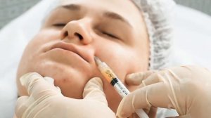 Увеличение губ плазмогелем - EPIC LOOK