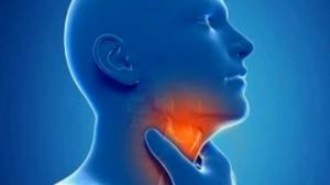 КАК БЫСТРО ИЗБАВИТЬСЯ ДАЖЕ ОТ СИЛЬНОЙ ИЗЖОГИ С ПОМОЩЬЮ ДОМАШНИХ СРЕДСТВ.