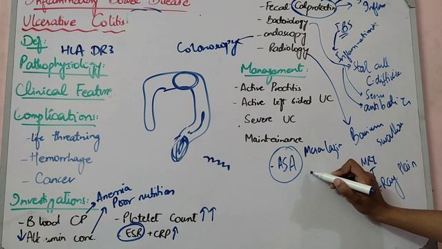 GIT MEDICINE lecture 9 ULCERATIVE COLITIS investigations and management made easy смотреть онлайн