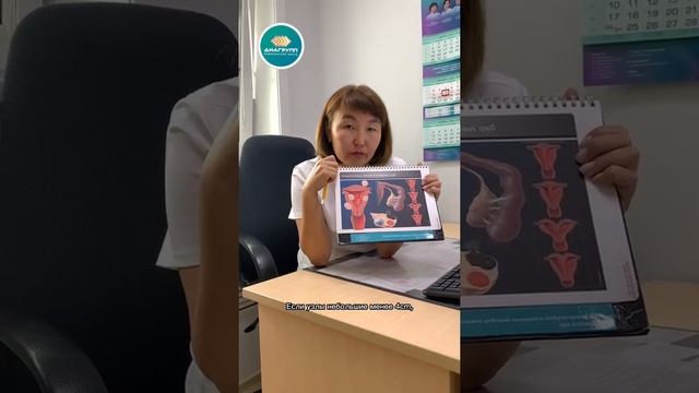 Можно ли при миоме делать ЭКО? смотреть онлайн