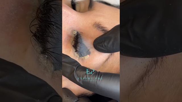 Ох уж эти тени на веках! Удаляем подтекший татуаж! смотреть онлайн