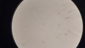 Кровь после аппликатора Кузнецова. Не ожидал