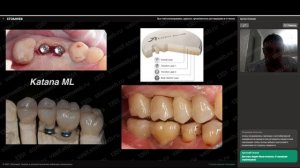 Артём Олексик - Все о металлокерамике, цирконе, провизионных реставрациях и оттисках