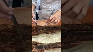 Анатомия - крестцовое сплетение