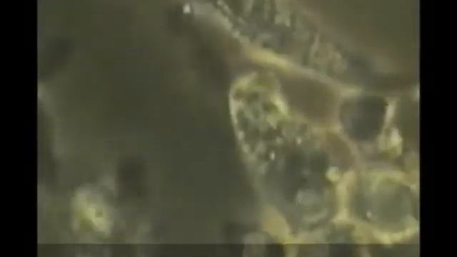 Противораковая защита нашего организма в действии смотреть онлайн