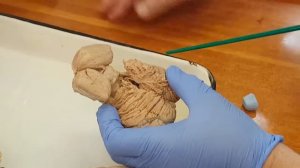 Головной мозг анатомия