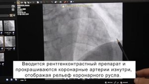 Коронарография. Норма.