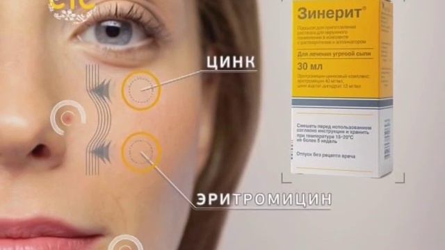 Зинерит Отзывы Фото До И После