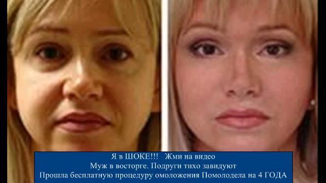 Watch Уход За Кожей Вокруг Глаз. Ирэн Влади. - Крем От Морщин Вокруг Глаз смотреть онлайн