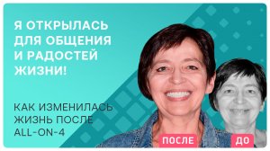 Все зубы на 4 имплантах – история пациентки из первых уст