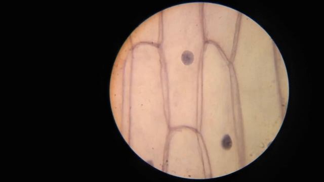 Кожица лука под микроскопом смотреть онлайн