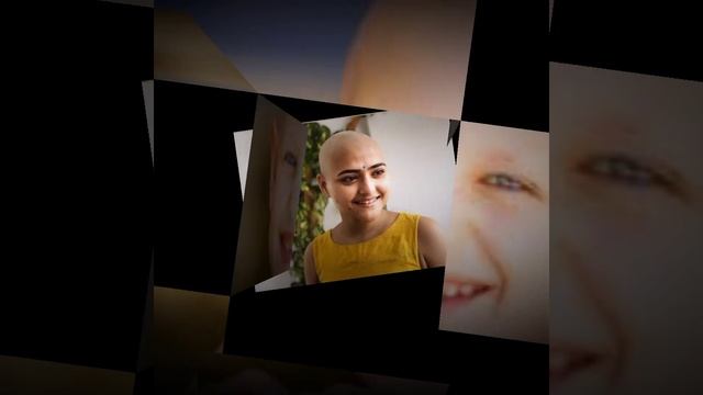 कैंसर पेशेंट गंजे क्यों हो जाते है? Why Cancer Patient Goes Bald! #shorts #backtobasics #a2 #a2sir