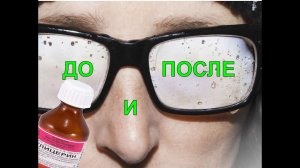 Рассказываю, что можно сделать, чтобы очки не запотевали зимой