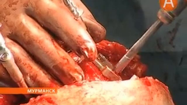 03 аккредитация медработников 12.04.2013 смотреть онлайн