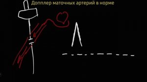 Допплер маточных артерий. Простая концепция