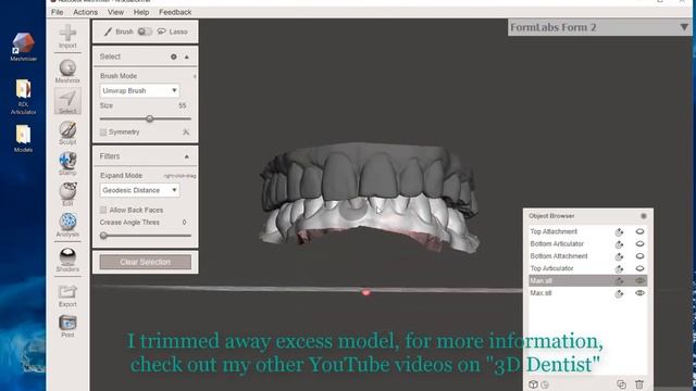 Building Dental Models with Articulators for 3D Printing in Meshmixer